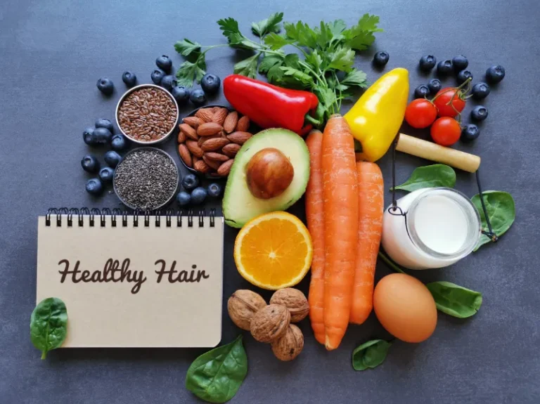 Top 5 Foods to Prevent Hair Loss
